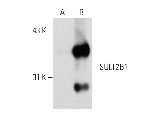 SULT2B1 (A-3): sc-166423. Western blot analysis of SULT2B1 expression in non-transfected: sc-117752 (A) and mouse SULT2B1 transfected: sc-127610 (B) 293T whole cell lysates.