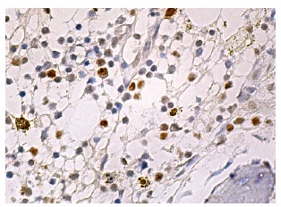 SULT2B1 (A-3): sc-166423. Immunoperoxidase staining of formalin fixed, paraffin-embedded human bone marrow tissue showing cytoplasmic and nuclear staining of subset of hematopoietic cells.