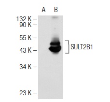 SULT2B1 (C-12): sc-46536. Western blot analysis of SULT2B1 expression in non-transfected: sc-117752 (A) and human SULT2B1 transfected: sc-113758 (B) 293T whole cell lysates.