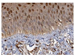 SULT2B1 (C-12): sc-46536. Immunoperoxidase staining of formalin fixed, paraffin-embedded human oral mucosa tissue showing nuclear staining of squamous epithelial cells at high magnification. Kindly provided by The Swedish Human Protein Atlas (HPA) program.