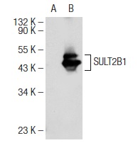SULT2B1 (C-14): sc-46537. Western blot analysis of SULT2B1 expression in non-transfected: sc-117752 (A) and human SULT2B1 transfected: sc-113758 (B) 293T whole cell lysates.