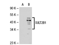 SULT2B1 (R-55): sc-67104. Western blot analysis of SULT2B1 expression in non-transfected: sc-117752 (A) and human SULT2B1 transfected: sc-113758 (B) 293T whole cell lysates.