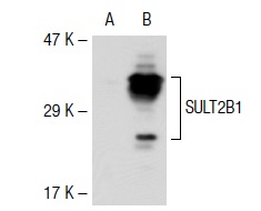SULT2B1 (R-55): sc-67104. Western blot analysis of SULT2B1 expression in non-transfected: sc-117752 (A) and mouse SULT2B1 transfected: sc-127610 (B) 293T whole cell lysates.