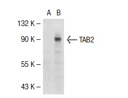 TAB2 (K-20): sc-11851. Western blot analysis of TAB2 expression in non-transfected: sc-117752 (A) and mouse TAB2 transfected: sc-123889 (B) 293T whole cell lysates.