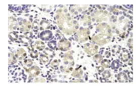 TARDBP (P-24): sc-102127. Immunoperoxidase staining of formalin fixed, paraffin-embedded human liver tissue showing nuclear and cytoplasmic staining.