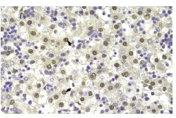 TARDBP (P-24): sc-102127. Immunoperoxidase staining of formalin fixed, paraffin-embedded human liver tissue showing nuclear and cytoplasmic staining.