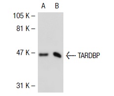 TARDBP (P-24): sc-102127. Western blot analysis of TARDBP expression in non-transfected: sc-117752 (A) and human TARDBP transfected: sc-111497 (B) 293T whole cell lysates.