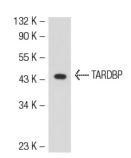 TARDBP (P-24): sc-102127. Western blot analysis of TARDBP expression in 293T whole cell lysate.