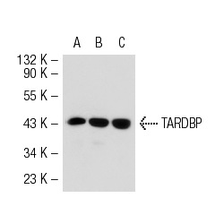 TARDBP (P-24): sc-102127. Western blot analysis of TARDBP expression in non-transfected 293T: sc-117752 (A), mouse TARDBP transfected 293T: sc-126075 (B) and Hep G2 (C) whole cell lysates.