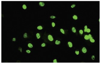 TARDBP (41-7.1): sc-100871. Immunofluorescence staining of paraformaldehyde-fixed HeLa cells showing nuclear localization.