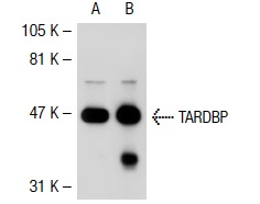 TARDBP (41-7.1): sc-100871. Western blot analysis of TARDBP expression in non-transfected: sc-117752 (A) and human TARDBP transfected: sc-111497 (B) 293T whole cell lysates.
