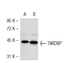 TARDBP (41-7.1): sc-100871. Western blot analysis of TARDBP expression in non-transfected: sc-117752 (A) and human TARDBP transfected: sc-129918 (B) 293T whole cell lysates.