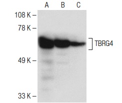 TBRG4 (F-1): sc-373948. Western blot analysis of TBRG4 expression in Hep G2 (A) and HeLa (B) whole cell lysates and human liver tissue extract (C).