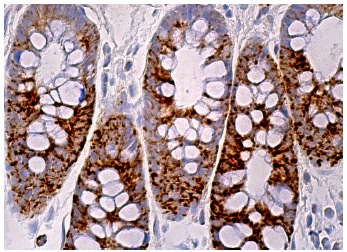 TBRG4 (F-1): sc-373948. Immunoperoxidase staining of formalin fixed, paraffin-embedded human rectum tissue showing cytoplasmic staining of glandular cells.