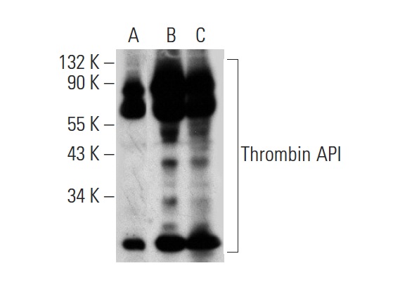 Thrombin API (H-85): sc-33769. Western blot analysis of Thrombin API expression in human platelet extract (A) and in human plasma (B) and human breast tissue extract (C).