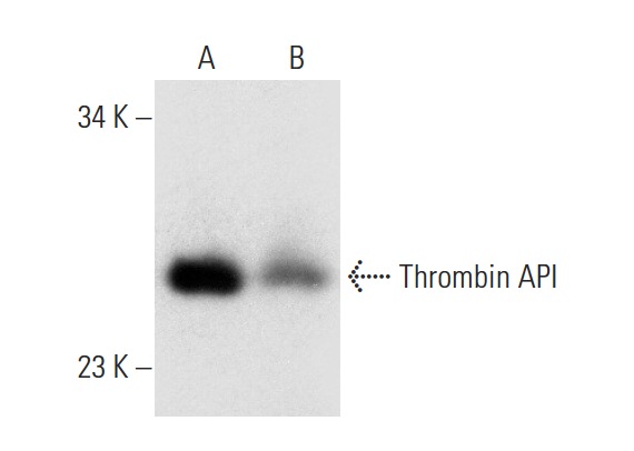 Thrombin API (H-85): sc-33769. Western blot analysis of Thrombin API in human plasma (A) and Thrombin API expression in human breast tissue extract (B).