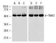 Western blot analysis of TRAF2 expression in Jurkat (A,D), A-431 (B,E) and WEHI-231 (C,F) whole cell lysates. Antibodies tested include TRAF2 (C-20): sc-876 (A-C) and TRAF2 (N-19): sc-877 (D-F).
