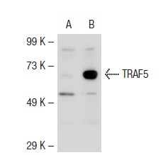 TRAF5 (H-257): sc-7220. Western blot analysis of TRAF5 expression in non-transfected: sc-117752 (A) and mouse TRAF5 transfected: sc-124243 (B) 293T whole cell lysates.