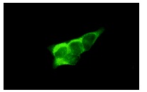 TRAF6 (D-10): sc-8409. Immunofluorescence staining of methanol-fixed A-431 cells showing cytoplasmic localization.