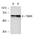 TRAF6 (D-10): sc-8409. Western blot analysis of TRAF6 expression in HeLa (A) and WEHI-3 (B) whole cell lysates.