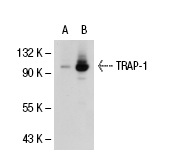 TRAP-1 (C-18): sc-8665. Western blot analysis of TRAP-1 expression in non-transfected: sc-117752 (A) and human TRAP-1 transfected: sc-113423 (B) 293T whole cell lysates.