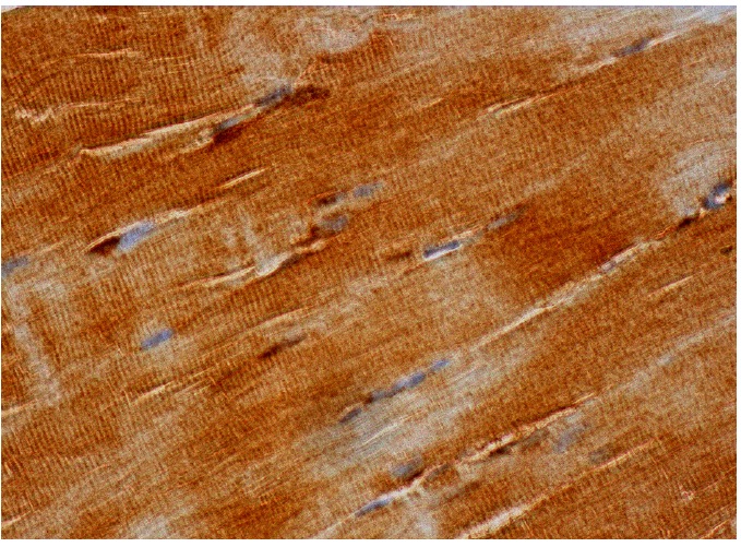 TRAP-1 Antibody (C-18): sc-8665. Immunoperoxidase staining of formalin fixed, paraffin-embedded human skeletal muscle tissue showing cytoplasmic staining of myocytes.