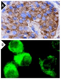 TRAP-1 (C-8): sc-13134. Immunoperoxidase staining of formalin-fixed, paraffin-embedded human pancreas tissue (A) and immunofluorescence staining of methanol-fixed MIA PaCa-2 cells (B) showing cytoplasmic localization.