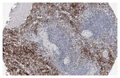 TRAP-1 (C-8): sc-13134. Immunoperoxidase staining of formalin fixed, paraffin-embedded human spleen tissue showing cytoplasmic staining of cells in red pulp. Kindly provided by The Swedish Human Protein Atlas (HPA) program.