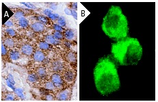 TRAP-1 (C-8): sc-13134. Immunoperoxidase staining of formalin-fixed, paraffin-embedded human pancreas tissue (A) and immunofluorescence staining of methanol-fixed MIA PaCa-2 cells (B) showing cytoplasmic localization.