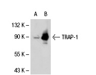 TRAP-1 (C-8): sc-13134. Western blot analysis of TRAP-1 expression in non-transfected: sc-117752 (A) and human TRAP-1 transfected: sc-113423 (B) 293T whole cell lysates.