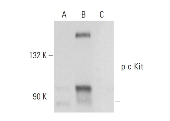 p-c-Kit (Tyr 568/570)-R: sc-18076-R. Western blot analysis of c-Kit phosphorylation in untreated (A), EGF treated (B) and EGF and lambda protein phosphatase treated (C) A-431 whole cell lysates.