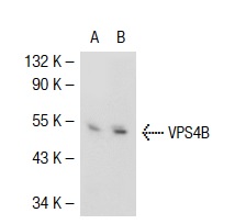 VPS4B (C-13): sc-21466. Western blot analysis of VPS4B expression in non-transfected: sc-117752 (A) and mouse VPS4B transfected: sc-124588 (B) 293T whole cell lysates.