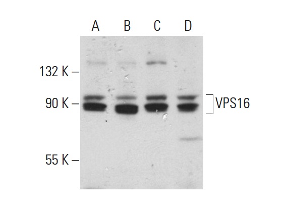 VPS16 (C-17): sc-86939. Western blot analysis of VPS16 expression in Jurkat (A), HuT 78 (B), AML-193 (C) and MDA-MB-231 (D) whole cell lysates.