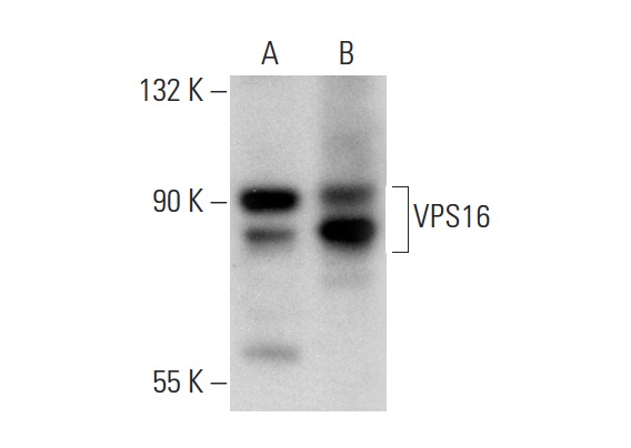 VPS16 (C-17): sc-86939. Western blot analysis of VPS16 expression in HeLa whole cell lysate (A) and mouse thymus tissue extract (B).