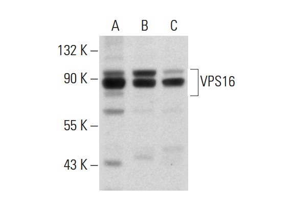 VPS16 (C-17): sc-86939. Western blot analysis of VPS16 expression in ES-2 (A), SK-MEL-28 (B) and MIA PaCa-2 (C) whole cell lysates.