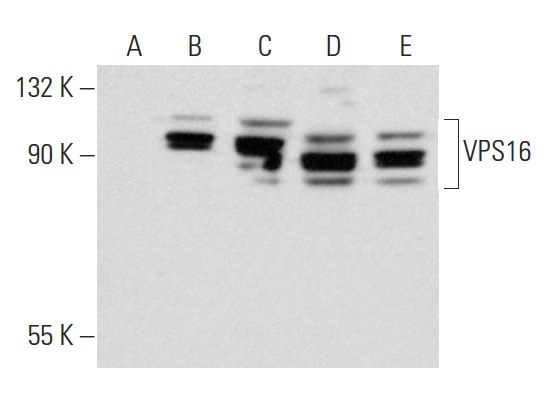 VPS16 (C-17): sc-86939. Western blot analysis of VPS16 expression in non-transfected 293T: sc-117752 (A), mouse VPS16 transfected 293T: sc-127767 (B), Jurkat (C), HuT 78 (D) and AML-193 (E) whole cell lysates.