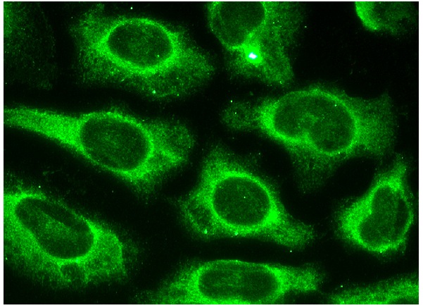 VPS16 (C-17): sc-86939. Immunofluorescence staining of methanol-fixed HeLa cells showing cytoplasmic localization.