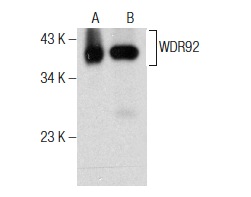 WDR92 (E-10): sc-376734. Western blot analysis of WDR92 expression in Sol8 nuclear extract (A) and mouse testis tissue extract (B).