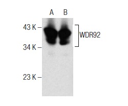 WDR92 (E-10): sc-376734. Western blot analysis of WDR92 expression in HL-60 (A) and ANC 3A (B) whole cell lysates.