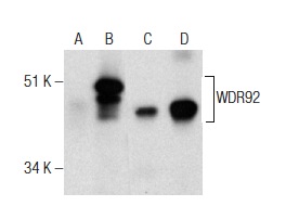 WDR92 (E-10): sc-376734. Western blot analysis of WDR92 expression in non-transfected 293T: sc-117752 (A), human WDR92 transfected 293T: sc-369521 (B) and HS 181.Tes (C) whole cell lysates and mouse testis tissue extract (D).