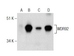 WDR92 (E-10): sc-376734. Western blot analysis of WDR92 expression in non-transfected 293T: sc-117752 (A), human WDR92 transfected 293T: sc-117086 (B) and HS 181.Tes (C) whole cell lysates and mouse testis tissue extract (D).
