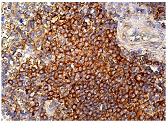 Wnt-4 (B-6): sc-376279. Immunoperoxidase staining of formalin fixed, paraffin-embedded human spleen tissue showing cytoplasmic staining of cells in white pulp.
