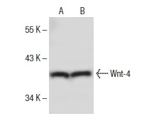 Wnt-4 (B-6): sc-376279. Western blot analysis of Wnt-4 expression in SK-BR-3 (A) and HeLa (B) whole cell lysates.