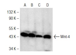 Wnt-4 (B-6): sc-376279. Western blot analysis of Wnt-4 expression in L929 (A) CSMLO (B), ESD3 (C) and ESD5 (D) whole cell lysates.