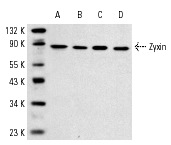 Zyxin (C-19): sc-6437. Western blot analysis of Zyxin expression in CCD-1064Sk (A), NIH/3T3 (B), Sol8 (C) and A-10 (D) whole cell lysates.