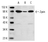 Zyxin (N-19): sc-6438. Western blot analysis of Zyxin expression in CCD-1064Sk (A), HeLa (B) and Hs68 (C) whole cell lysates.