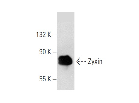 Zyxin (H-200): sc-15338. Western blot analysis of Zyxin expression in HeLa whole cell lysate.