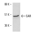 CAR (N-17): sc-10313. Western blot analysis of CAR expression in mouse brain tissue extract.