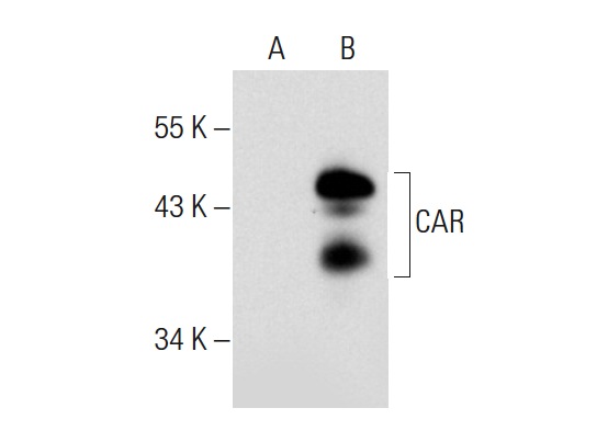 CAR (N-17): sc-10313. Western blot analysis of CAR expression in non-transfected: sc-111760 (A) and human CAR transfected: sc-110476 (B) 293 whole cell lysates.