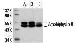 Amphiphysin II (2F11): sc-23918. Western blot analysis of Amphiphysin II expression in C2C12 (A), Sol8 (B) and L8 (C) whole cell lysates.